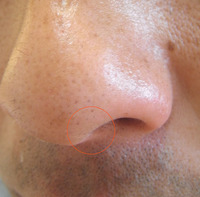 鼻毛１印.jpg